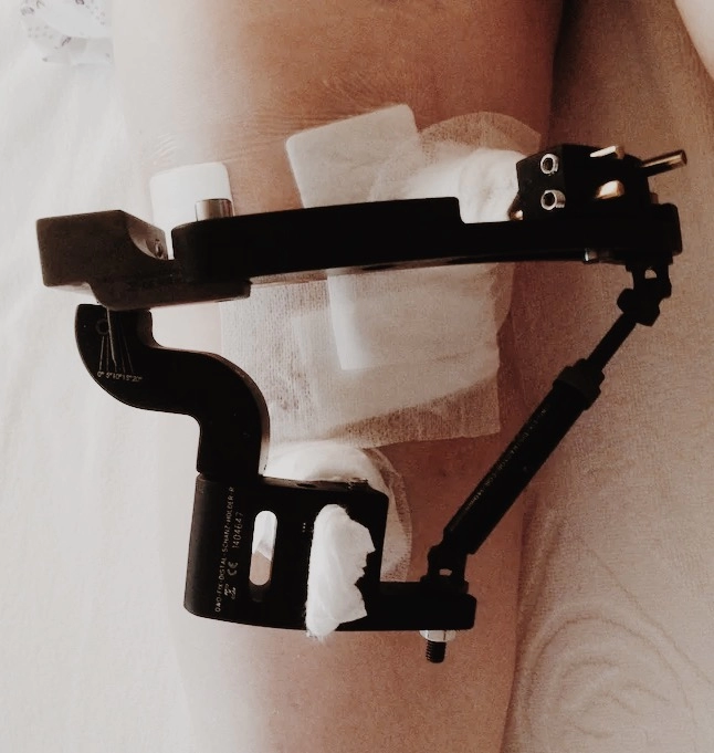 Deformite Düzeltme Ameliyatı