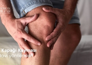 Diz Kapağı Kayması ve Tedavi Yöntemleri