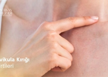 Klavikula Kırığı Belirtileri